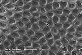 9 - Cellule epitalliche in visione superficiale